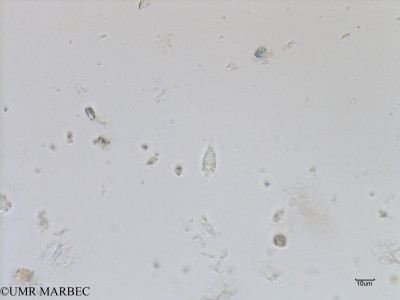 phyto/Bizerte/bizerte_bay/RISCO July 2016/Oxytoxum turbo (Baie_T1A-oxytoxum cf turbo ou variabile-6).tif(copy)_thumb.jpg